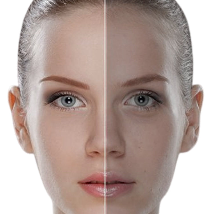 Dull Skin