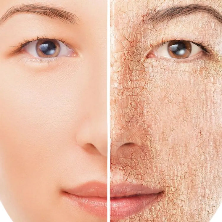 Dry Skin Valle Verde Labs